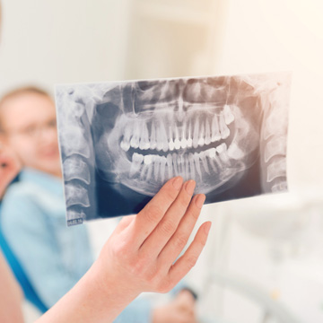 why dentist remove wisdom teeth