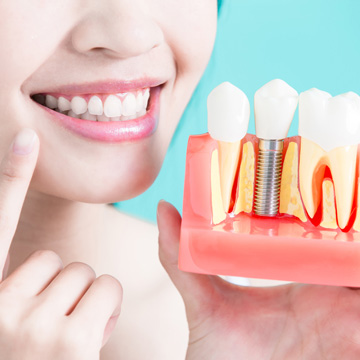 dental implant risk