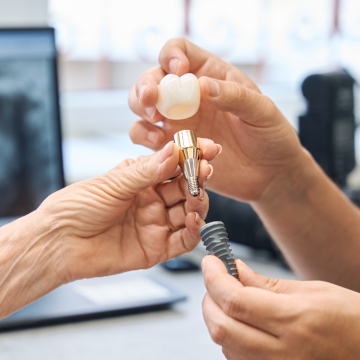 dental implant material